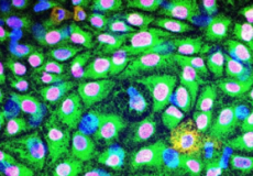 伪装干细胞衍生移植物可避免免疫排斥