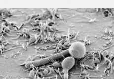 白色念珠菌毒素在消化道定植中发挥特殊作用