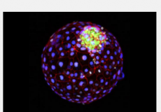 干细胞模型首次展示人类早期发育